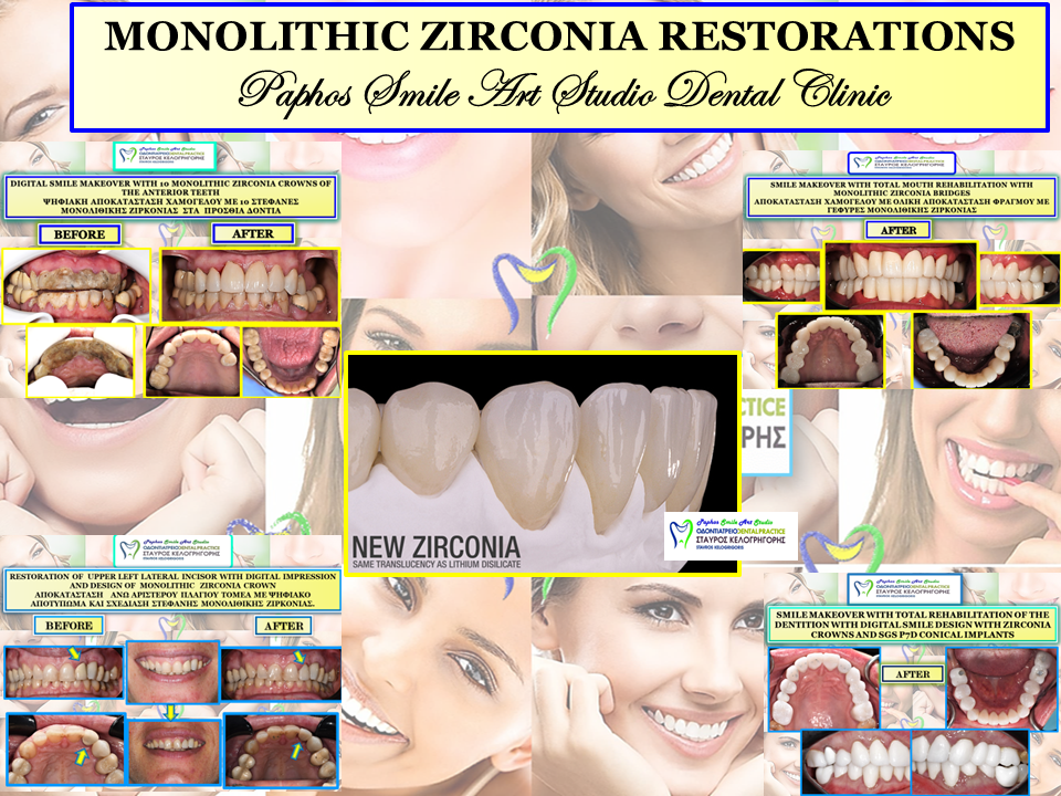 paphos smile art studio dental clinic